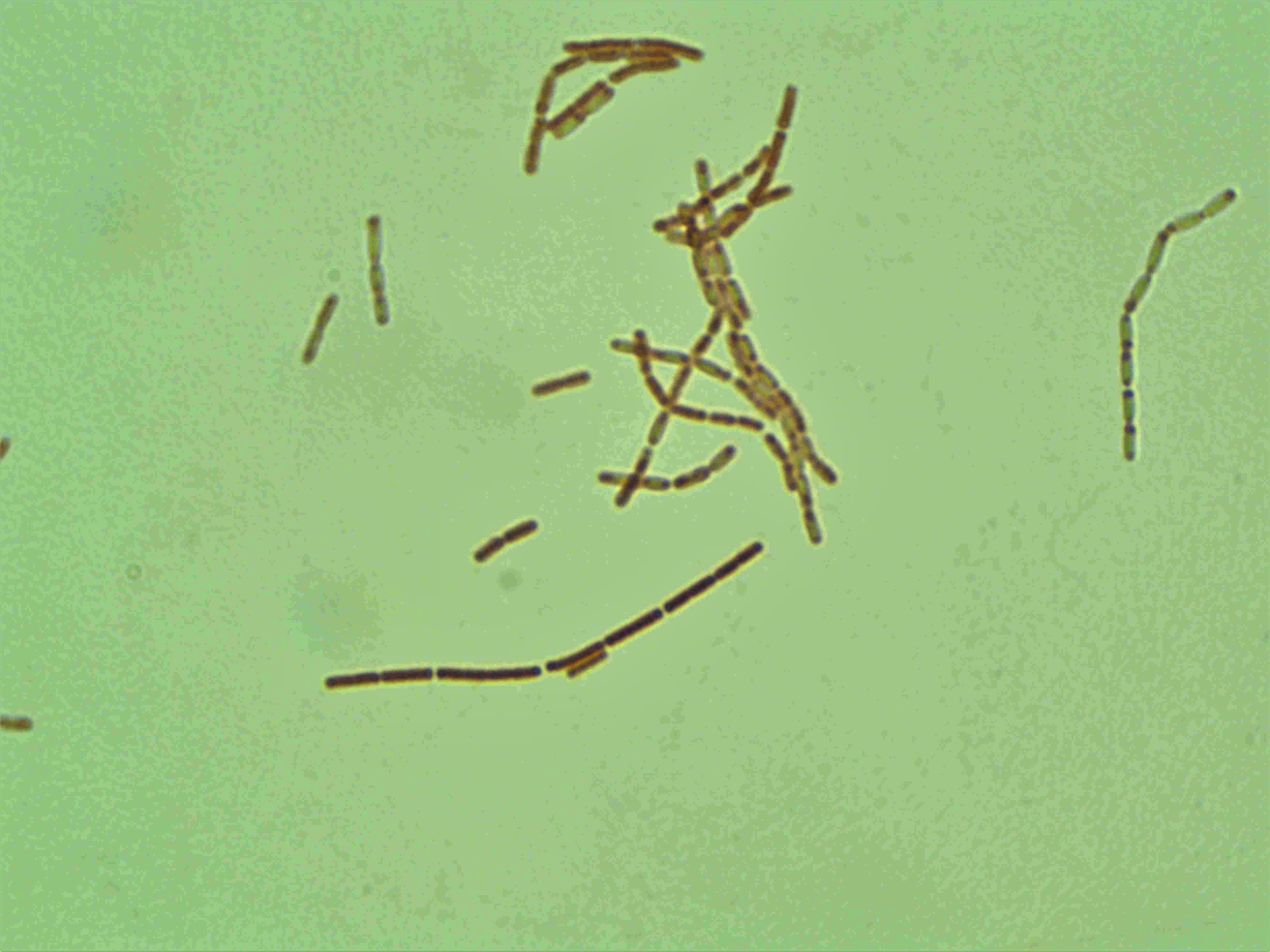 CM 1176 (BTK) S.K (002)